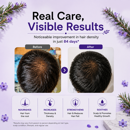Rosemerry Hair Spray – For Hair Growth
