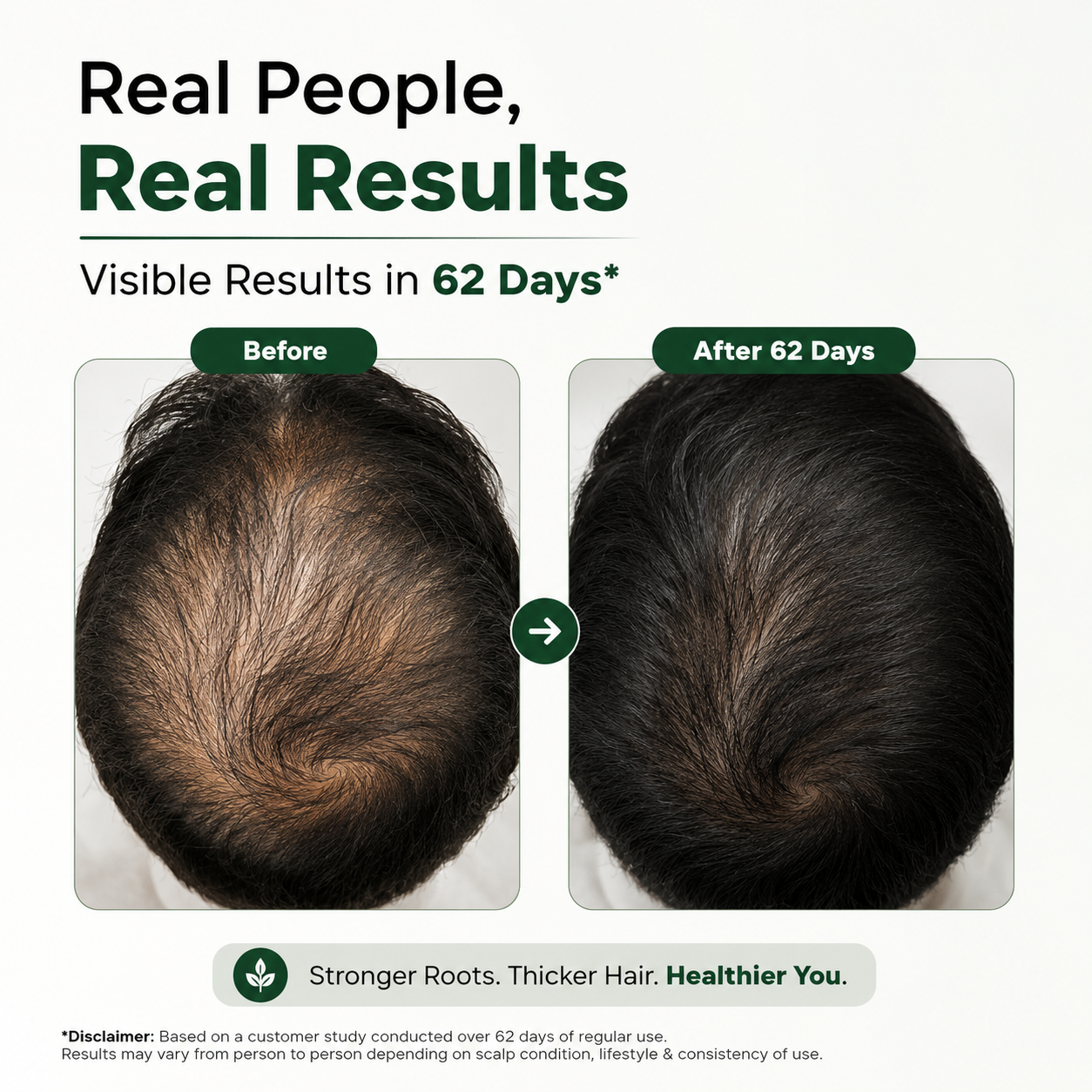 Ancient Hair Growth Oil – 15+ Ayurvedic Herbs