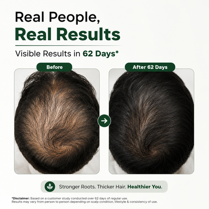 Ancient Hair Growth Oil – 15+ Ayurvedic Herbs