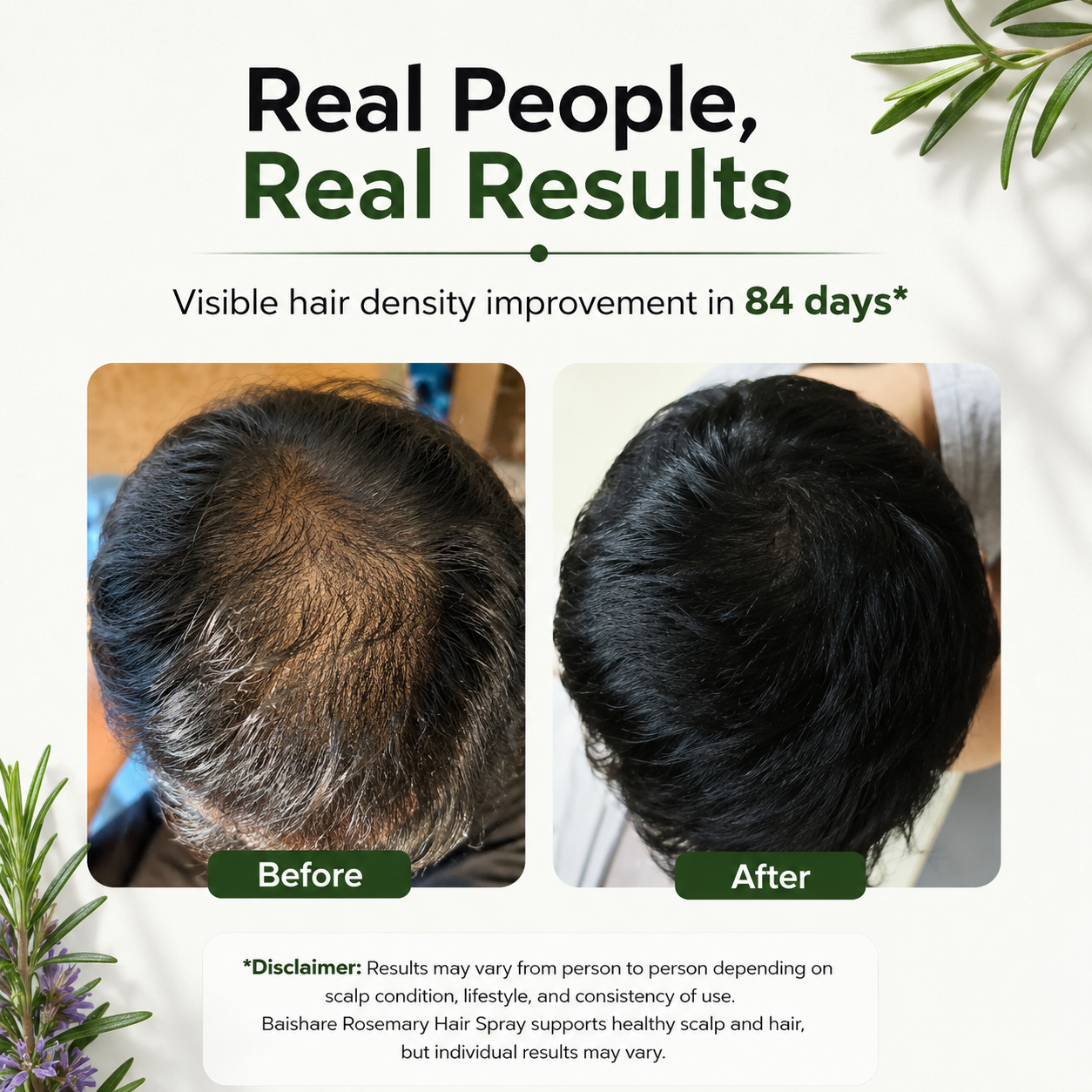 Rosemerry Hair Spray – For Hair Growth